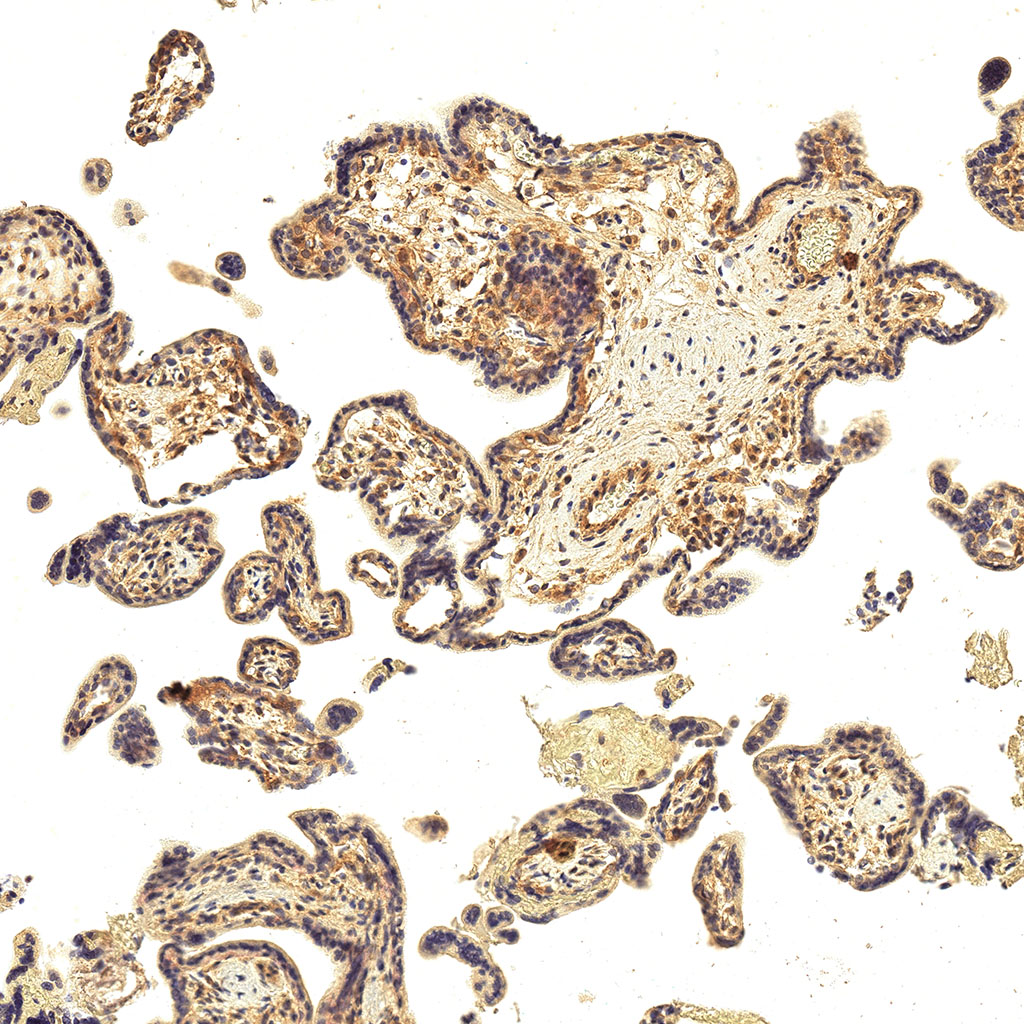 sars-cov-2 gene expression in a human fetus